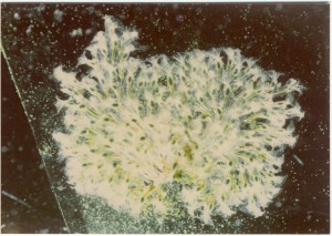 Bryozoa